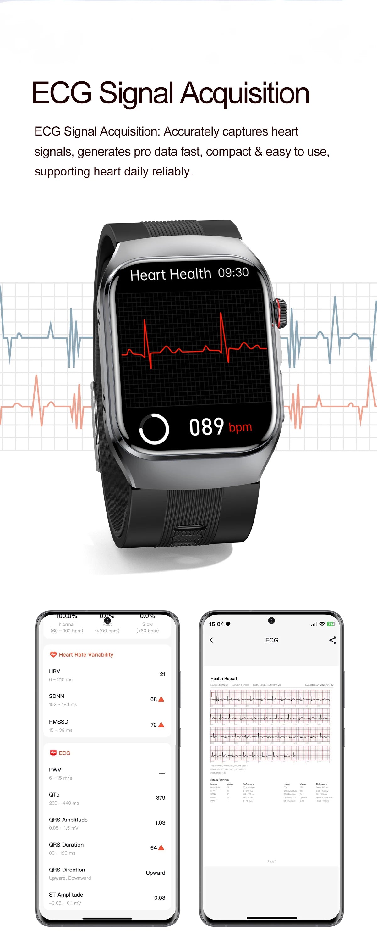 Smart Health Watch with ECG & Blood Pressure Monitoring – AMOLED Fitness Tracker Bracelet